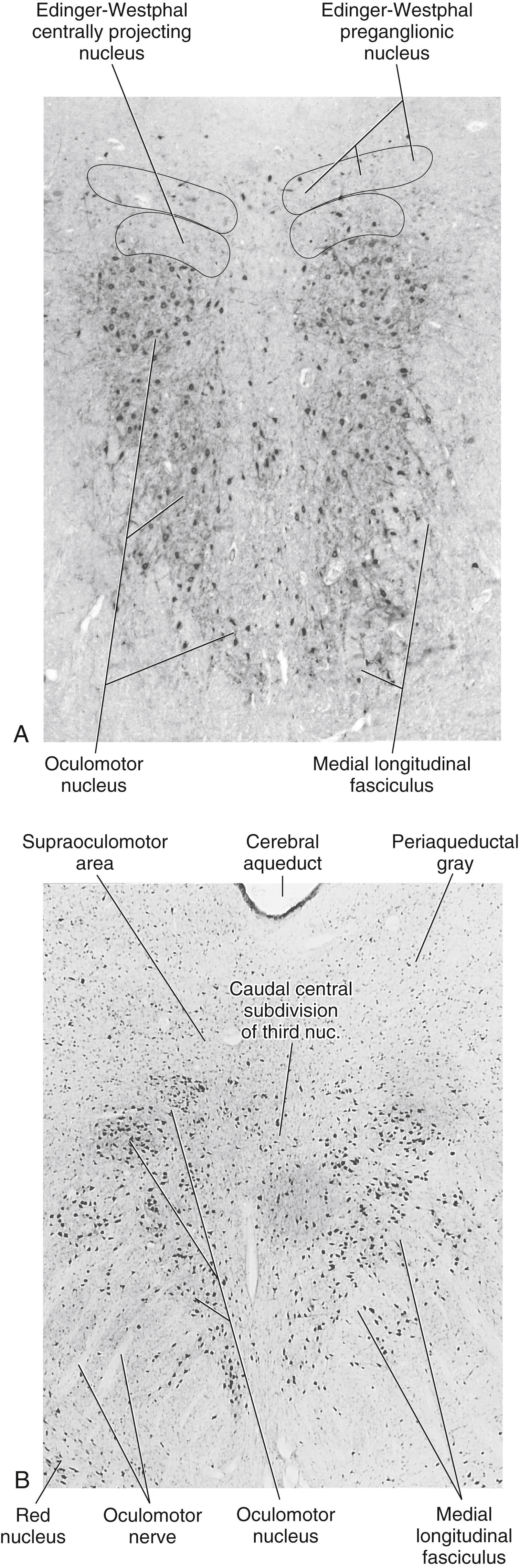 Fig. 28.6, Frontal sections through the human oculomotor complex at rostral ( A ) and caudal ( B ) levels. The tissue in A has been stained immunohistochemically to reveal the presence of choline acetyltransferase, which is found in cholinergic motor neurons. Thus, the motor neurons within the oculomotor nucleus, as well as the motor neurons found in the preganglionic subdivision of the Edinger-Westphal complex, are stained. The peptidergic cells of the centrally projecting subdivision of the Edinger-Westphal complex are not stained. B is a Nissl-stained section showing the oculomotor nucleus and select adjacent structures.