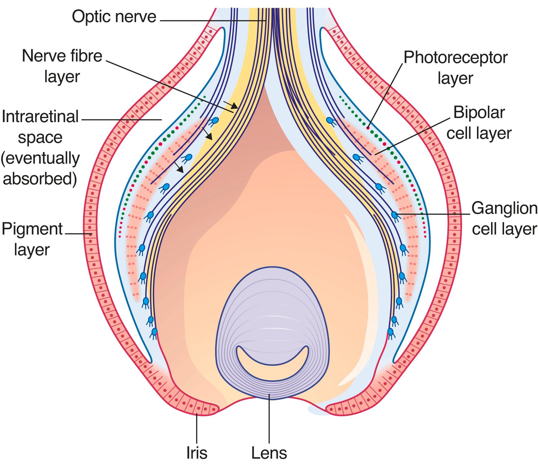 Fig. 31.1, Embryonic retina. Green and red represent rods and cones, respectively.