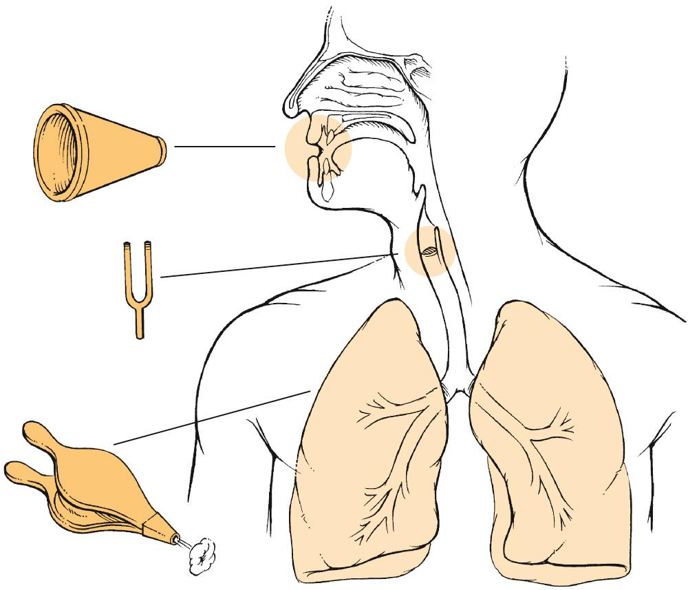 Fig. 111.3, Normal speech requires a bellows (pulmonary airflow), a sound source (vocal folds with vibrating mucosa), and a vocal tract, in which the articulators transform the laryngeal sound into intelligible speech.