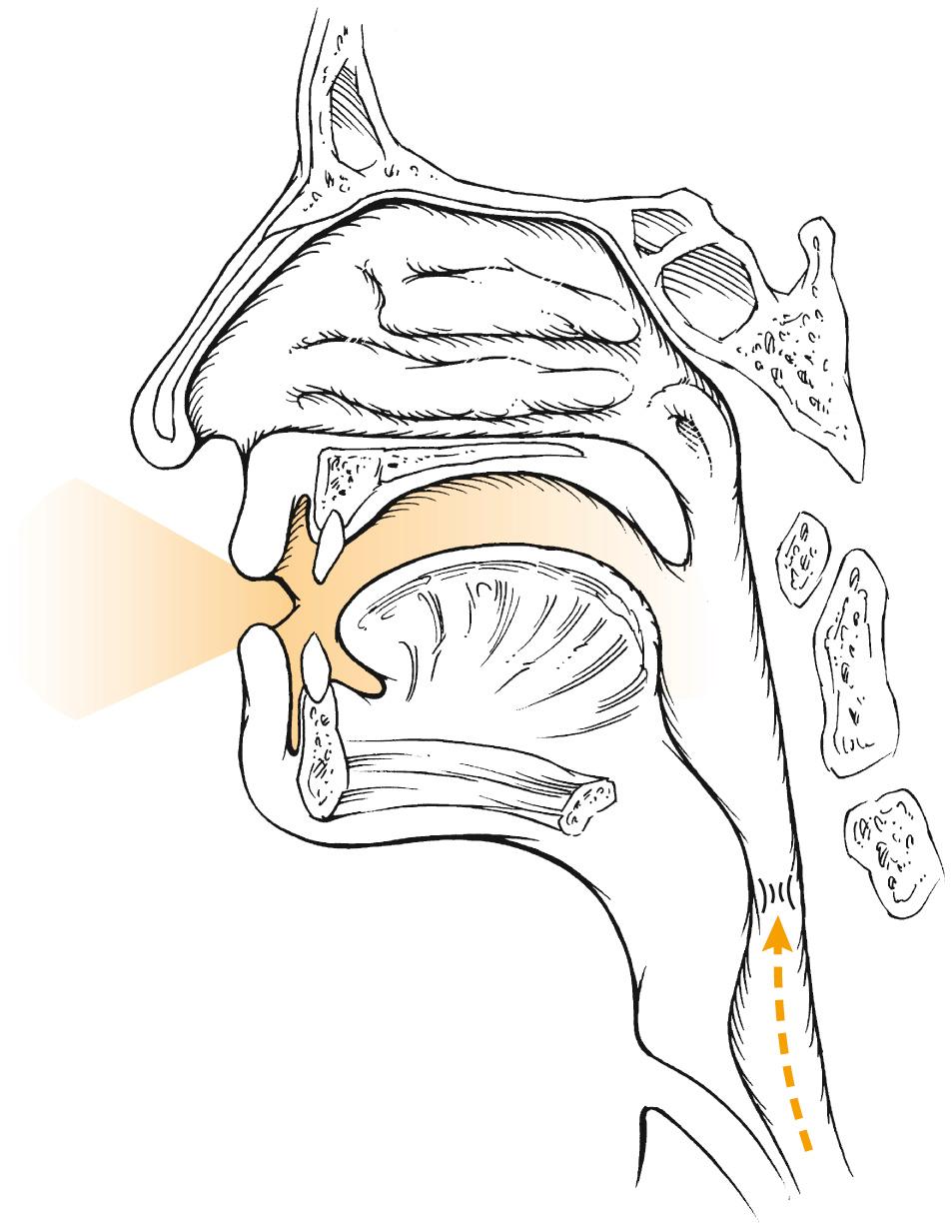 Fig. 111.4, Esophageal speech.