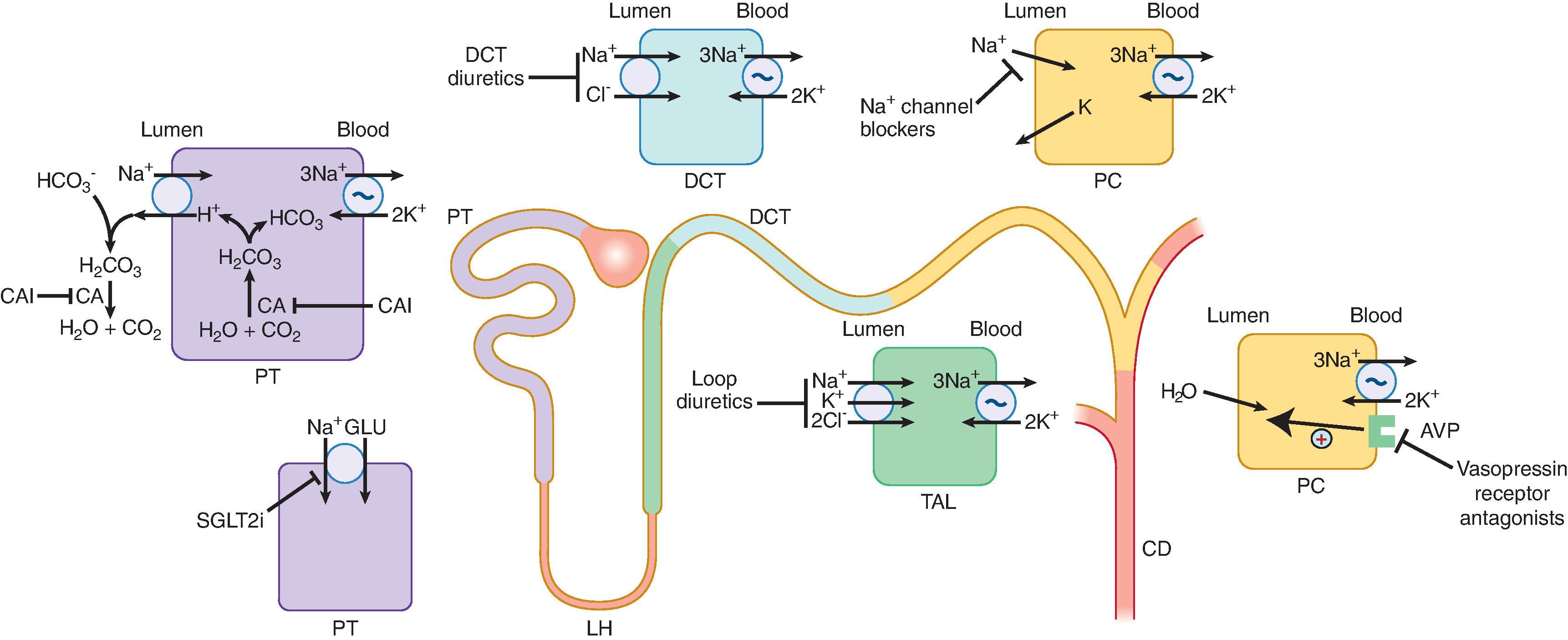 Fig. 9.1, Predominant sites and mechanisms of action of clinically important diuretic drugs. Patterns identify sites of action along the nephron and corresponding cell types affected. The proximal tubule (PT, purple segment) is represented by a typical PT cell. The sodium hydrogen exchanger (NHE-3) and sodium glucose cotransporter 2 (SGLT2) are responsible for the majority of sodium reclamation in the PT. The loop of Henle (LH) includes a thick ascending limb (TAL, green segment), and a typical TAL cell is shown in green. The sodium-potassium-2 chloride cotransporter (NKCC2) absorbs sodium via the luminal aspect of the membrane. The distal convoluted tubule (DCT, blue segment) is represented by a typical DCT cell in blue. The sodium chloride cotransporter (NCC) and epithelial sodium transporter (ENaC) regulate sodium reabsorption at this level. The collecting duct (CD, yellow and orange segments) includes principal cells (PC), shown in yellow. Note that, for clarity, two principal cells are shown. Both water and salt pathways exist in the same cells. Both intracellular and luminal actions of carbonic anhydrase (CA) inhibitors in suppressing CA are important in their ability to reduce sodium reabsorption by the kidney proximal tubule. Note that sodium channel blockers probably act along the last half of the DCT and in the connecting tubule as well as in the CD. Spironolactone and eplerenone (not shown) are competitive mineralocorticoid receptor antagonists and act primarily in the cortical collecting tubule. Aquaretics, such as conivaptan or tolvaptan, inhibit water reabsorption by PC by blocking the action of arginine vasopressin on V2 receptors. V2 receptors facilitate insertion of aquaporin 2 water channels in the luminal membrane.