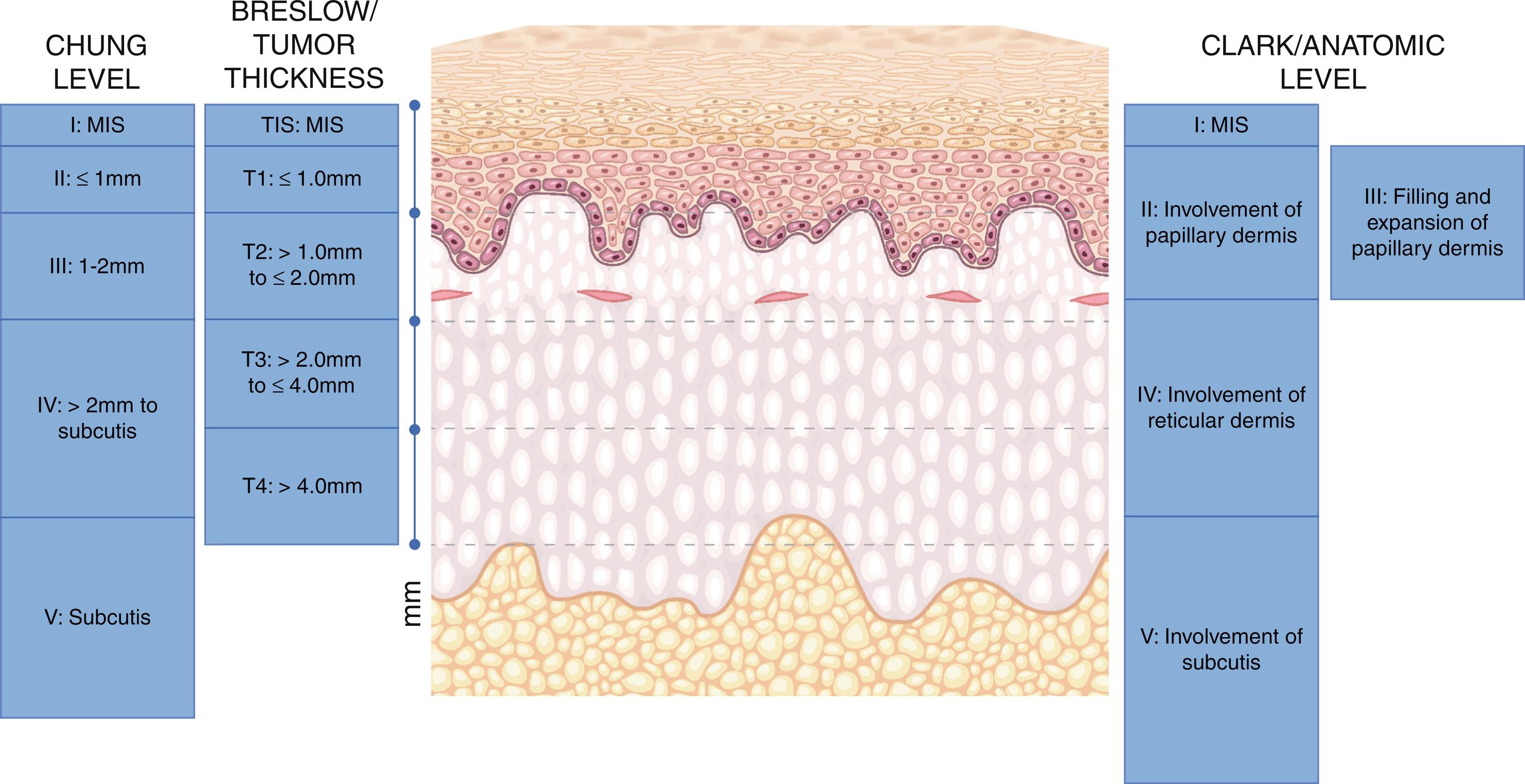 Fig. 17.6, Methods for evaluating extent of dermal/subdermal involvement.