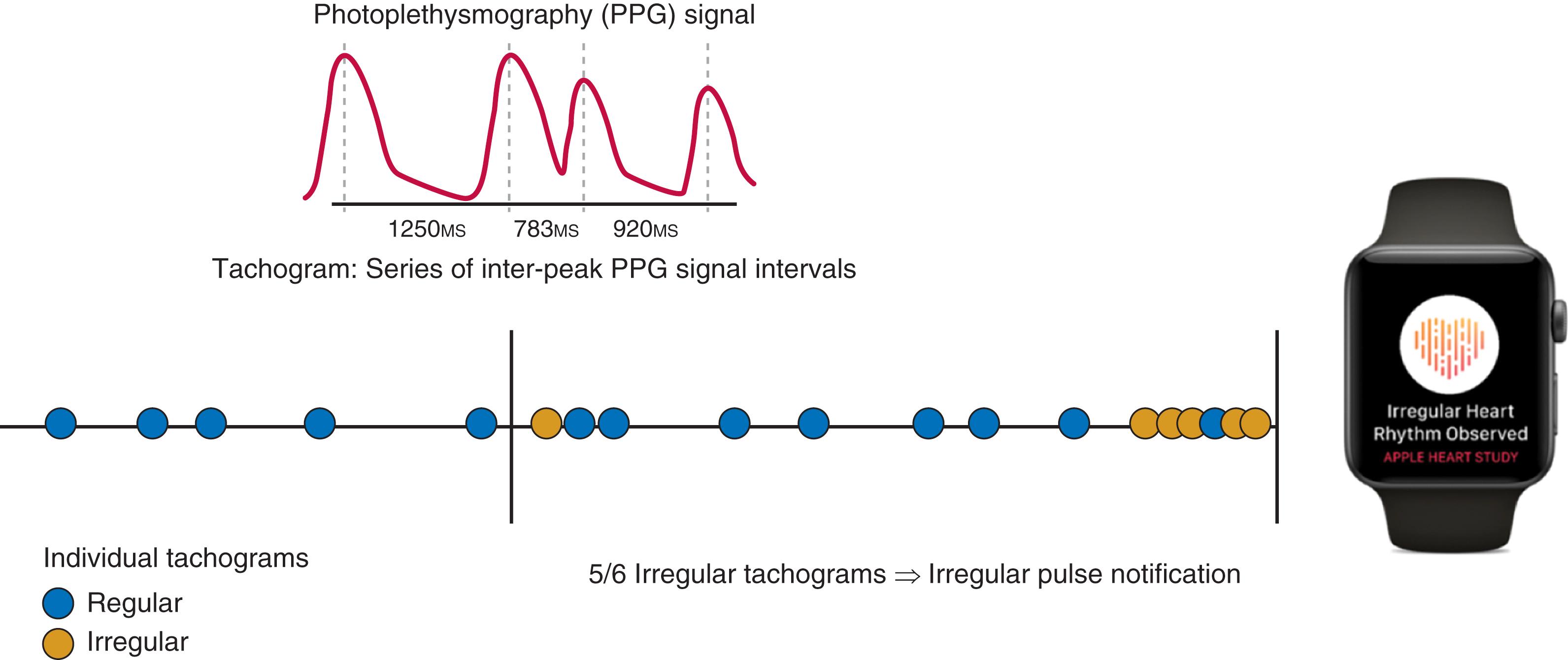 FIGURE 12.3, Irregular pulse detection algorithm.