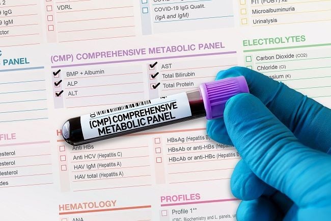 chloride blood test