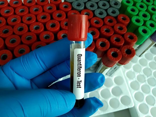 quantiferon gold test