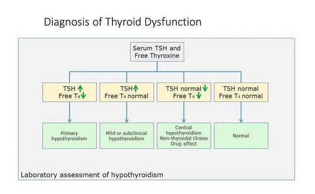 Thyroid labs