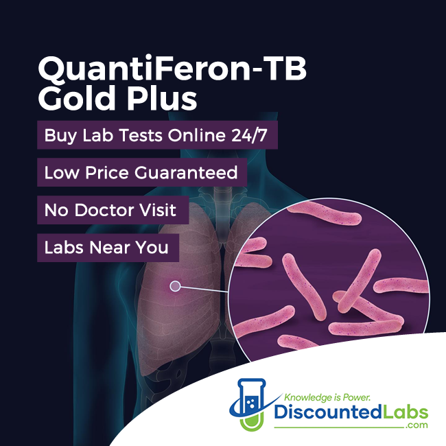 tb blood test near me