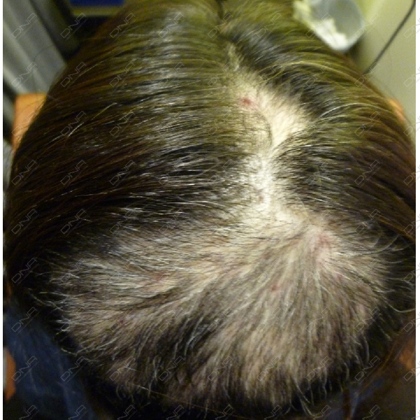 case1_1b