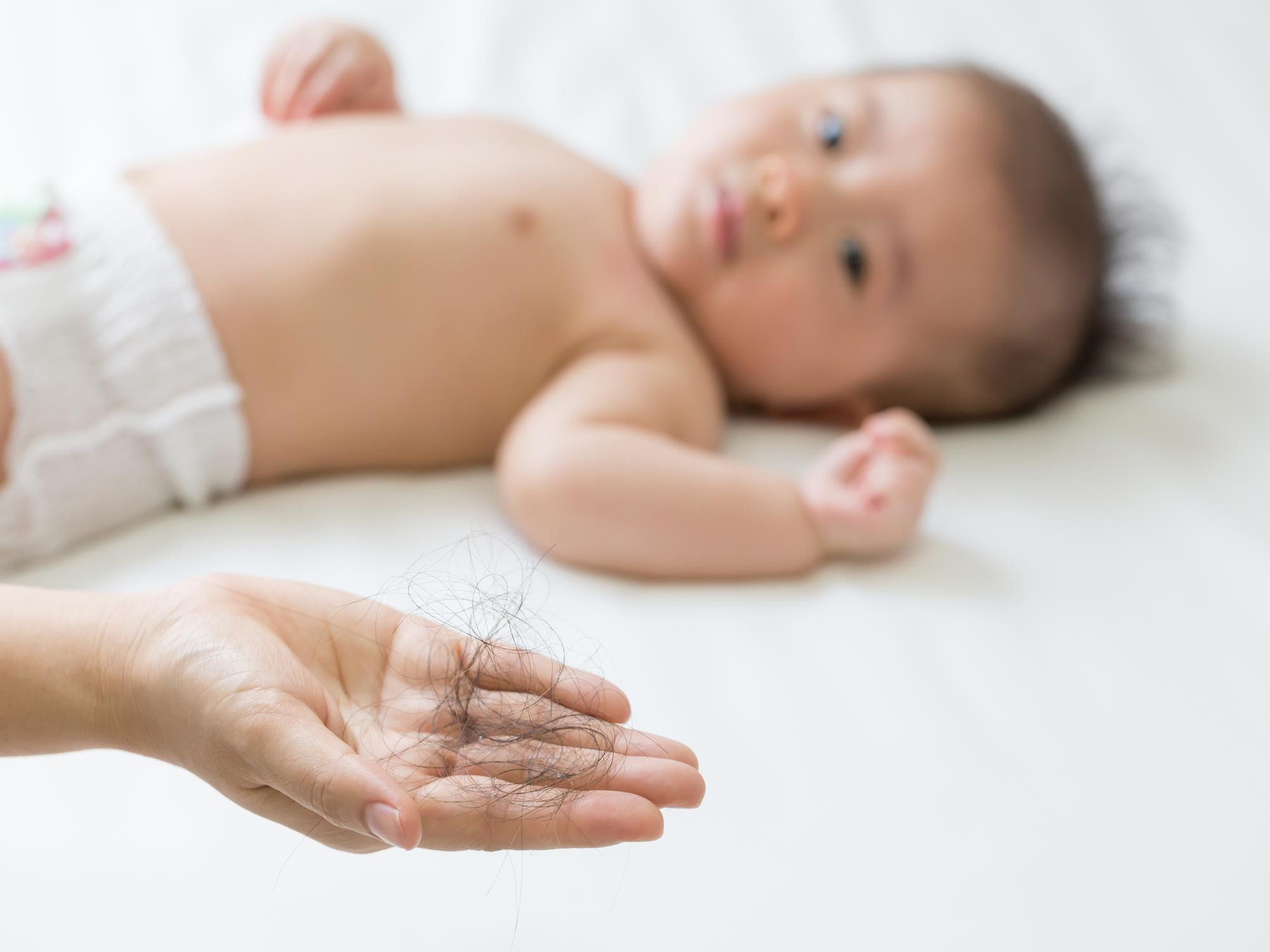 【產後脫髮】生BB甩頭髮幾時完？髮理顧問解構4個改善方法