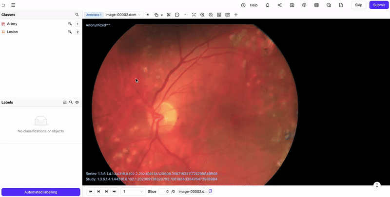 Grayscale filter with DICOM/NIfTi