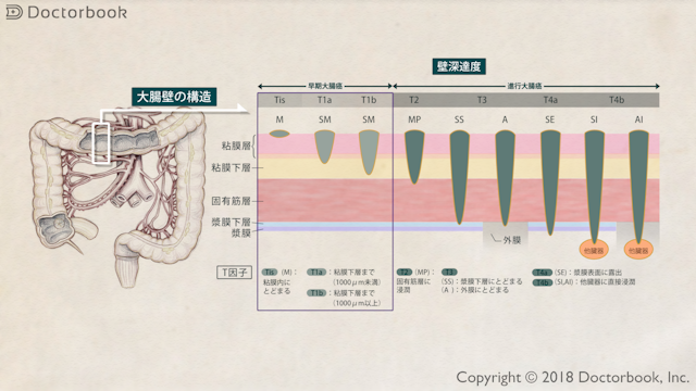 大腸壁の断面図