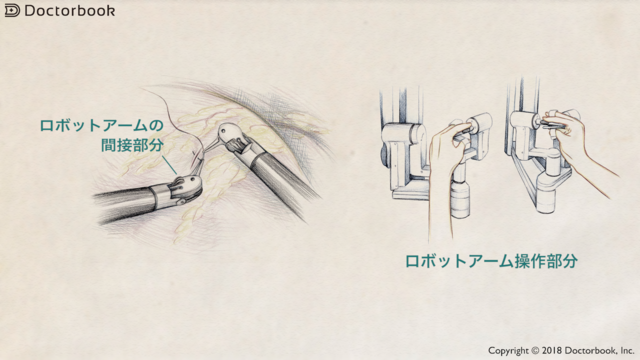 手術支援ロボット『ダヴィンチ』とは