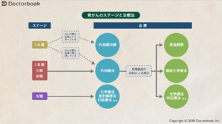 胃がん、縮小手術は可能？