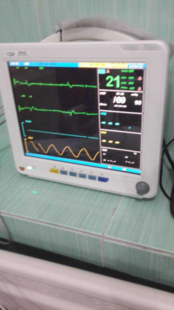 Ekg total av blok derajat 3 stripalllossy1ssl1