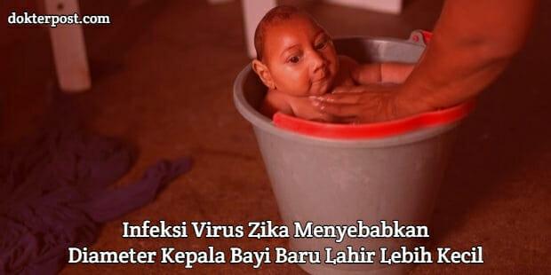Infeksi virus zika stripalllossy1ssl1