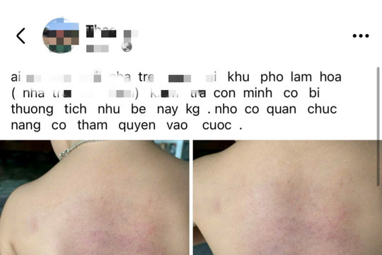 Hàm Thuận Bắc: Xác minh thông tin clip bảo mẫu đánh trẻ tại nhà trẻ tư thục