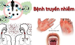 Bộ Y tế: Dịch bệnh truyền nhiễm có nguy cơ lây lan các biến thể mới