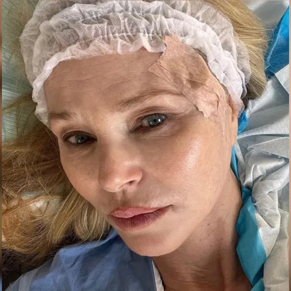 Christie Brinkley Shares Photo After Skin Cancer Procedure: “Stitched Me Up To Perfection Like An Haute Couture Dior”