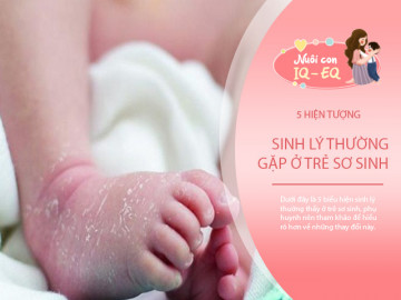 5 hiện tượng sinh lý thường gặp ở trẻ sơ sinh, nhưng ai lần đầu làm bố mẹ đều tưởng con bệnh Dạy con 0-6 tháng