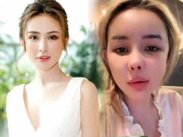 Dàn hot girl gần như “thay mặt” vì dao kéo: Bạn thân Huyền Baby suýt hoại tử cằm, Ngân 98 mặt biến dạng