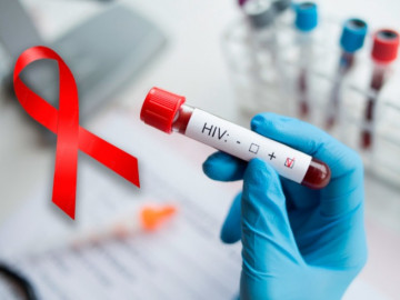 Những điều cần biết về xét nghiệm HIV trong thai kỳ Sức khỏe bà bầu