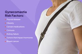 Bệnh Gynecomastia là gì?