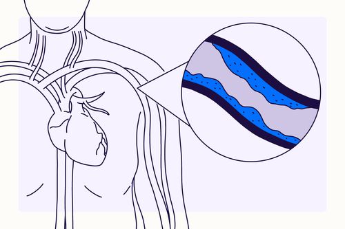 Tổng quan về cholesterol