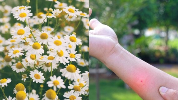 Chamomile cho vết muỗi cắn: 7 Những cách dễ dàng để được giải thoát