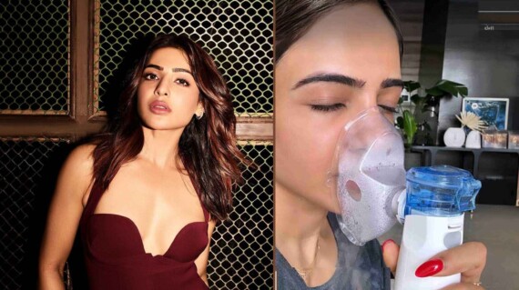 Samantha Ruth Prabhu gây ra cuộc tranh luận bằng cách dùng hydro peroxide để giải phóng