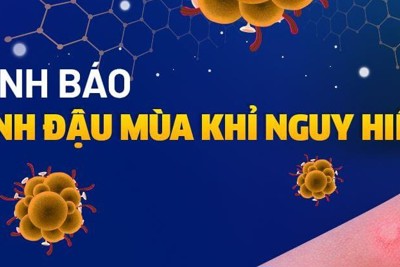 Dập tắt ổ dịch đậu mùa khỉ tại Cà Mau