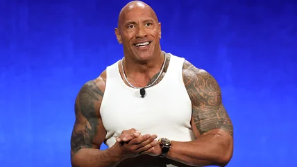 Dwayne Johnson bị thương khi bị A24 Bộ phim & nó trông tàn bạo