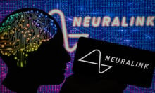 Neuralink của Elon Musk lần đầu tiên cấy chip não vào người