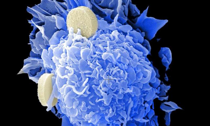 New method discovered to halt active cancer cells