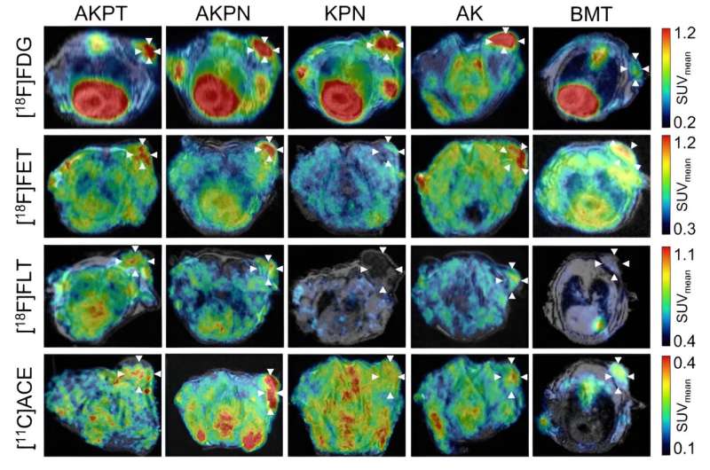 New imaging technology for diagnosing and treating bowel cancer patients