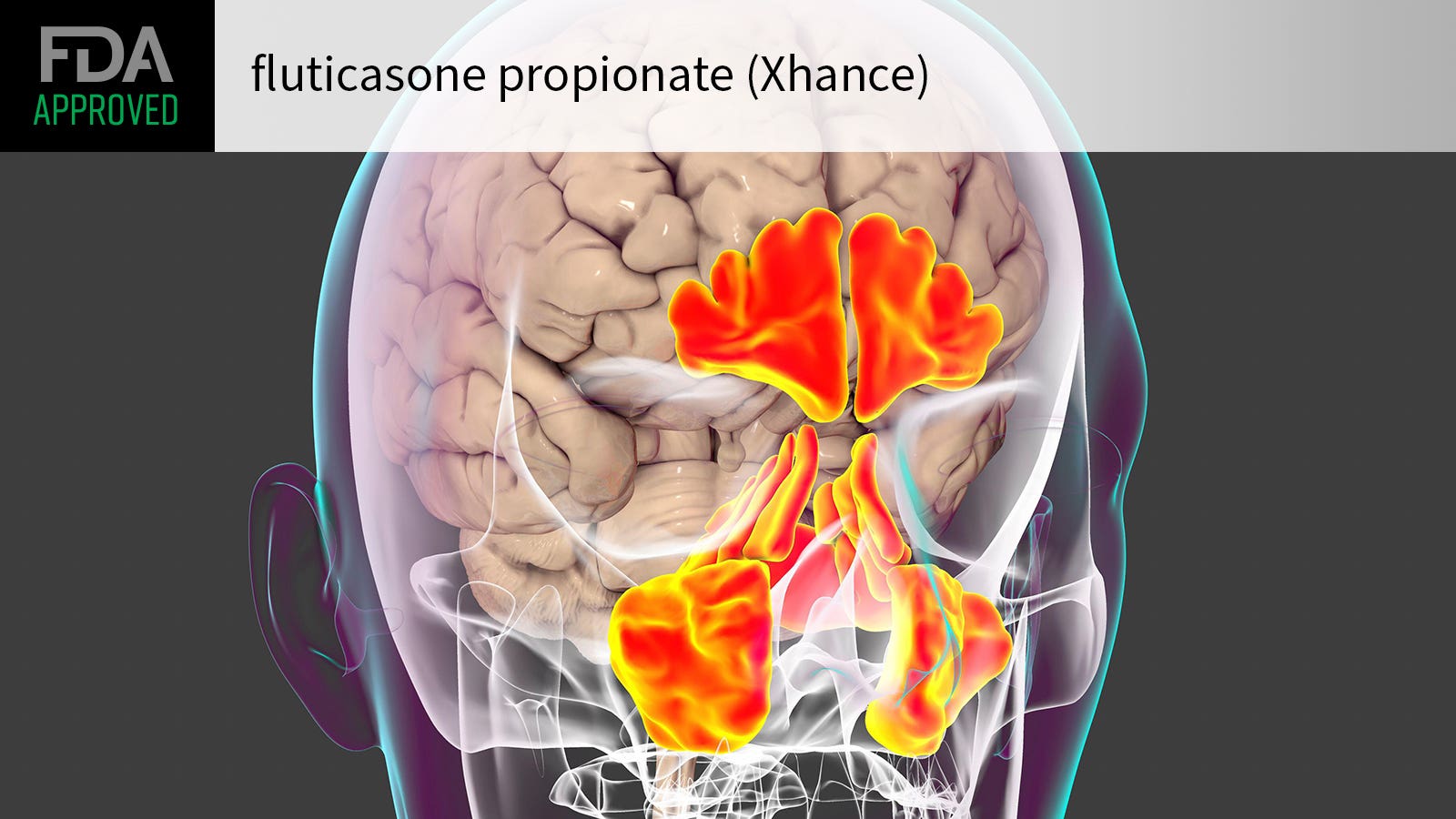 First Treatment Approved for Chronic Rhinosinusitis Without Nasal Polyps