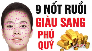 Nữ giới có nốt ruồi vị trí này là số phú quý, sau 20 giàu sang, từ 30 tiền vào như nước