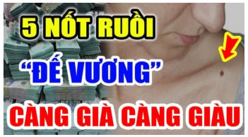 5 nốt ruồi "Đế Vương" càng già càng giàu: Ai có 1/5 cũng viên mãn cả đời, rất đáng chúc mừng