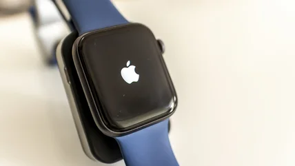 Apple Watch bị treo khi cập nhật? Đây là những gì có thể sai