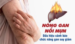 Nóng gan nổi mụn – Dấu hiệu cảnh báo chức năng gan suy giảm