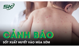 Cảnh báo sốt xuất huyết vào mùa sớm