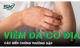 Biến chứng của viêm da cơ địa