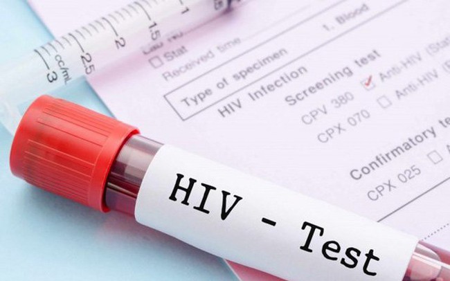 Chia sẻ kinh nghiệm triển khai xét nghiệm nhiễm mới HIV