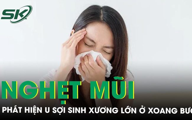 Nghẹt mũi, nhức đầu, cô gái trẻ bất ngờ mắc u mũi xoang