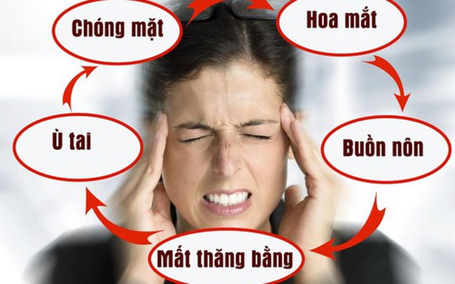 Rối loạn tiền đình ở người trẻ phải làm gì?