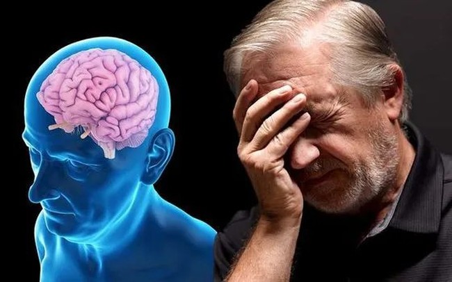 Thuốc điều trị bệnh Alzheimer giai đoạn đầu