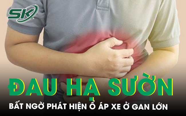 Đau nhiều vùng hạ sườn phải, bất ngờ phát hiện ổ áp xe ở gan lớn