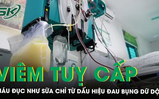 Đau bụng dữ dội người đàn ông cấp cứu hút ra 5 lít huyết tương có màu như sữa