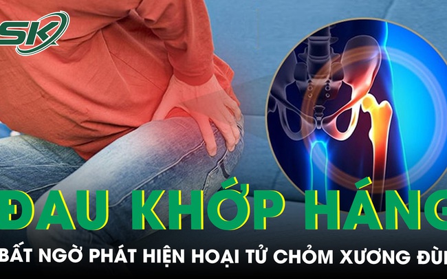 Đau khớp háng dữ dội đi khám bất ngờ phát hiện hoại tử chỏm xương đùi