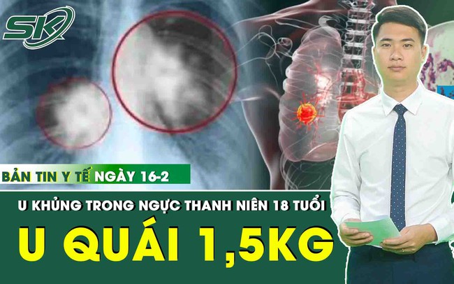 Tổng hợp những thông tin y tế nóng nhất ngày 16/2