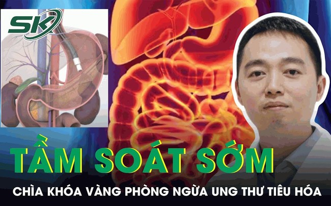 Tầm soát sớm là chìa khóa vàng phòng ngừa ung thư đường tiêu hóa